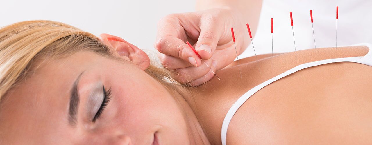 Intramuscular Stimulation/Dry Needling - PhysioPlusPhysioplus Whitehorse